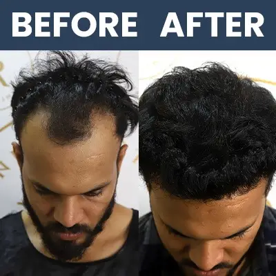 Hair Result Sep 2024